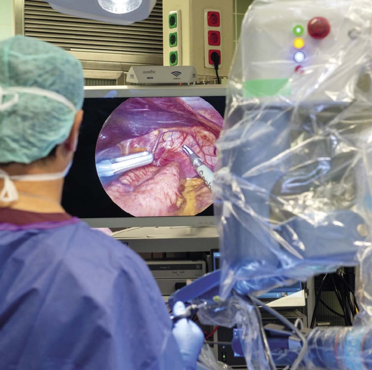 Endoskopischer Blick in den Situs eines Kindes und Kamerasteuerung durch den...