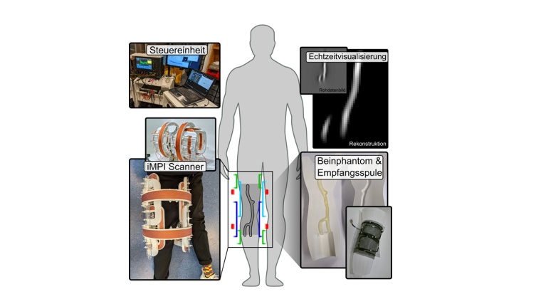 Der iMPI-Scanner ist so klein und leicht, dass man ihn fast überall mitnehmen...