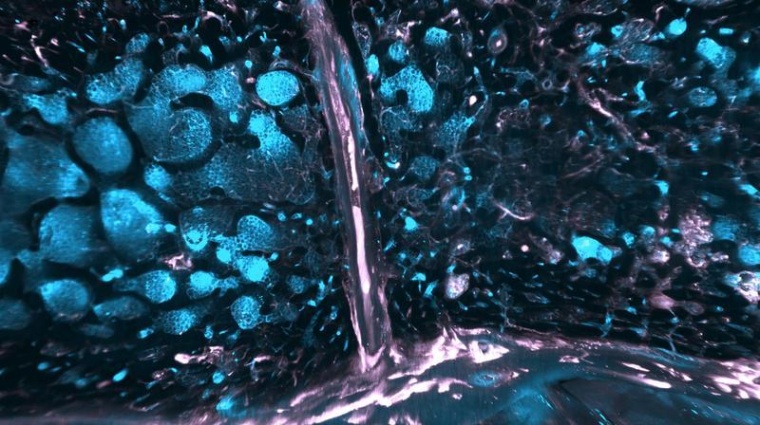 Immune cells in blue and vessels in pink in the bone marrow of the skull. Foto:...