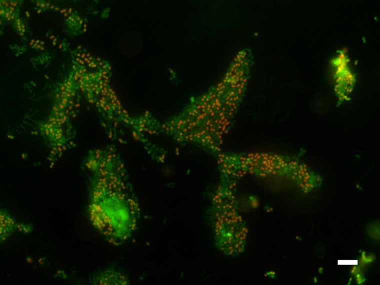 Bei Stress durch hohe Salzkonzentrationen sterben nach einigen Tagen zwar eine...