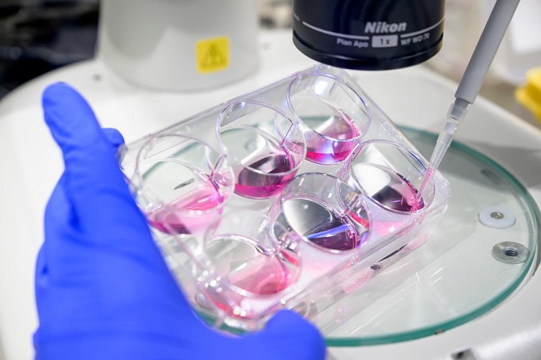 Forschende aus Berlin haben einen neuen Ansatz zur Behandlung autoimmuner...