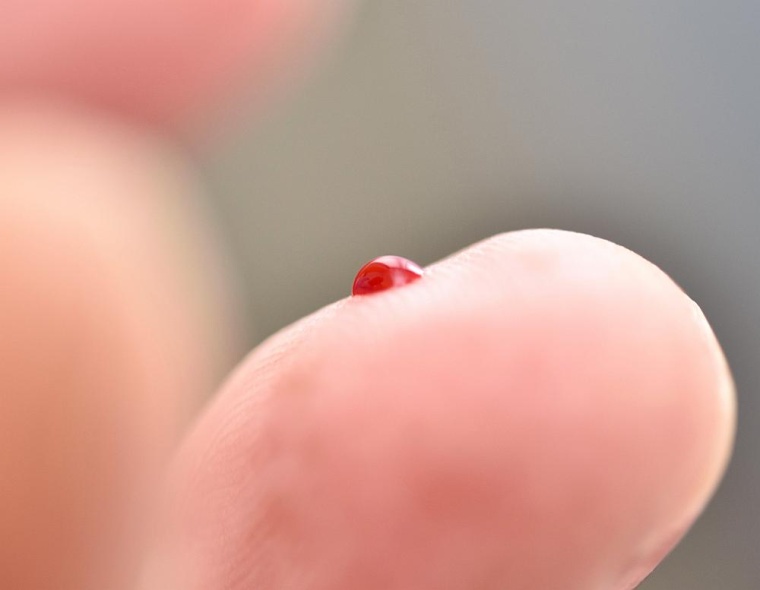 Den Blutzucker immer genau im Blick haben: Denn das Diabetische Fußsyndrom...