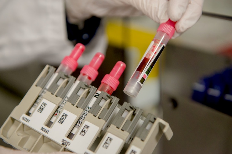 Zwei Werte aus einer Blutprobe – mehr braucht es nicht, um einem beginnenden...