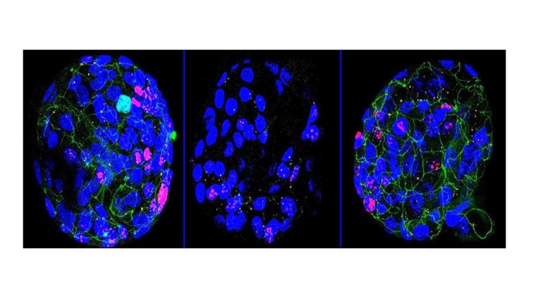 Humane Colon-Organoide (blau) mit drei Treg-Zellkulturen: Unter...