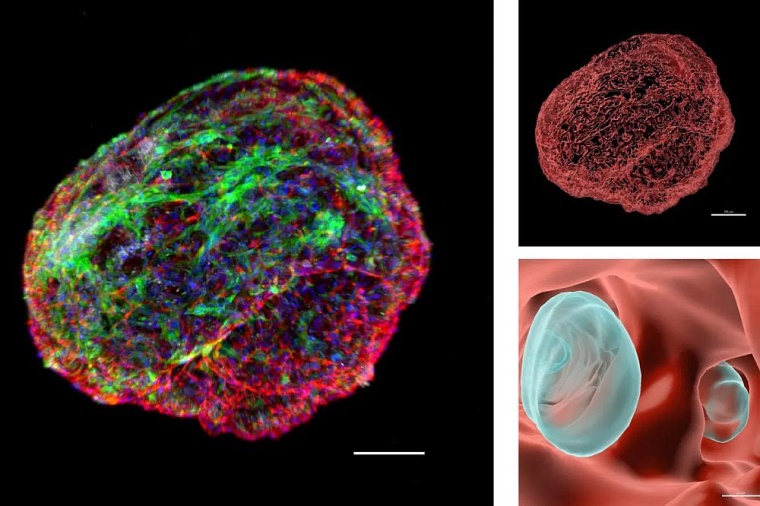 Links: Knochenmarkorganoid mit Gefäßnetzwerk (rot), Bindegewebszellen...