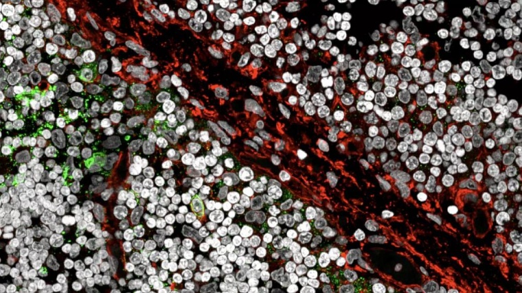 Eines der großen Rätsel der Immunologie: Bisher war unbekannt, welche...