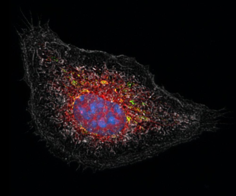 Eine durch einen Entzündungsreiz aktivierte Fresszelle, die mit Kortison...