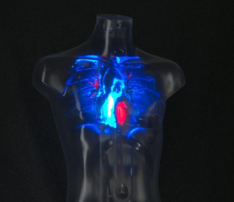 Hingucker auf der Messe ist das durchsichtige Model eines menschlichen Torsos,...