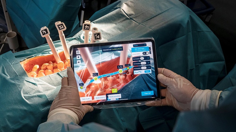 Exakte Berechnung der Stab-Positionen mit Hilfe der AR Foto: Neo Medical