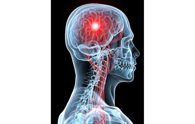 Foto: Getty Images 117849405