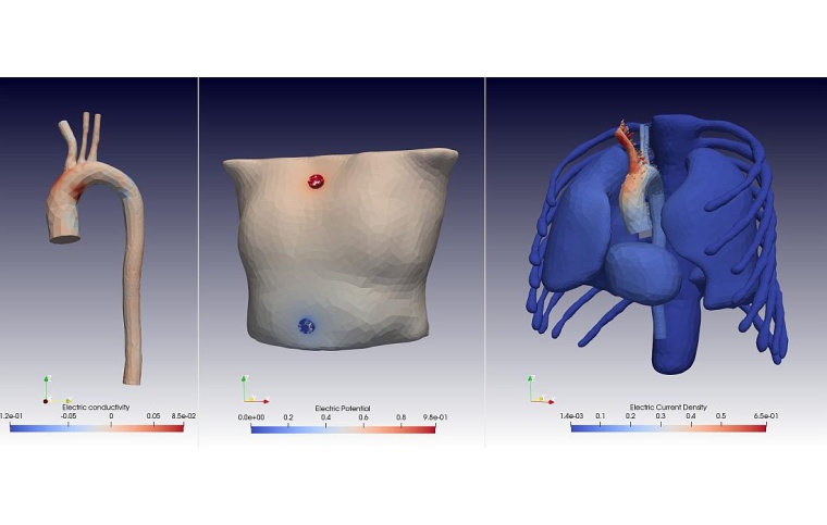 In den Simulationen lassen sich Änderungen in den elektrischen Feldern genau...