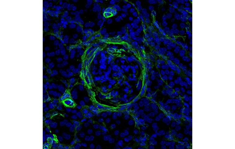 Nierengewebe (Lupus-Mausmodell) mit Zeichen von beginnender Fibrose (grün)....