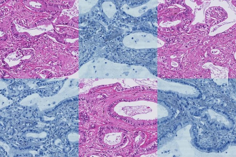 Das Bildregistrierungsverfahren Histokat-Fusion überträgt Annotationen aus...