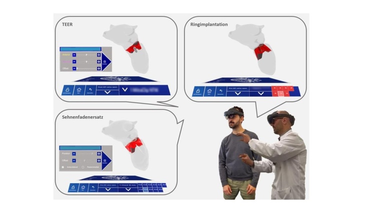 Minimaki ermöglicht Patient*innenaufklärung und Planung von...