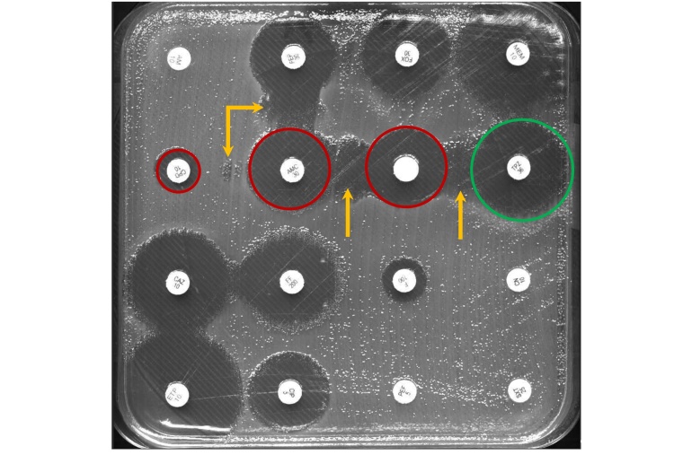 Kirby-Bauer-Disk-Diffusionstest von Darmbakterien und Antibiotika getränkte...