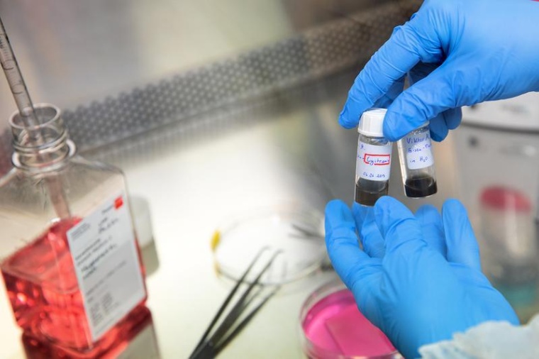 Medikamentenentwicklung zur Behandlung Schwerstverbrannter: Neues...