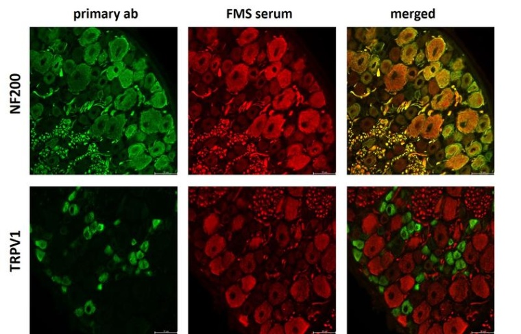 Bindung von Antikörpern gegen Neurofilament 200 (NF200) und den...