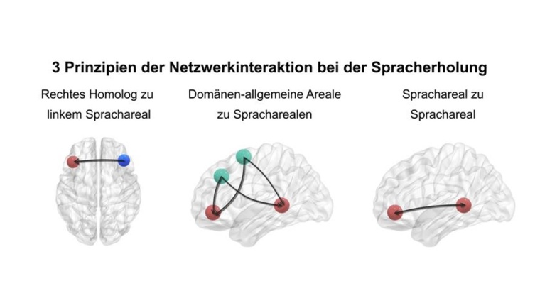 Drei Prinzipien der Netzwerkinteraktion bei der Spracherholung Grafik: Dr....