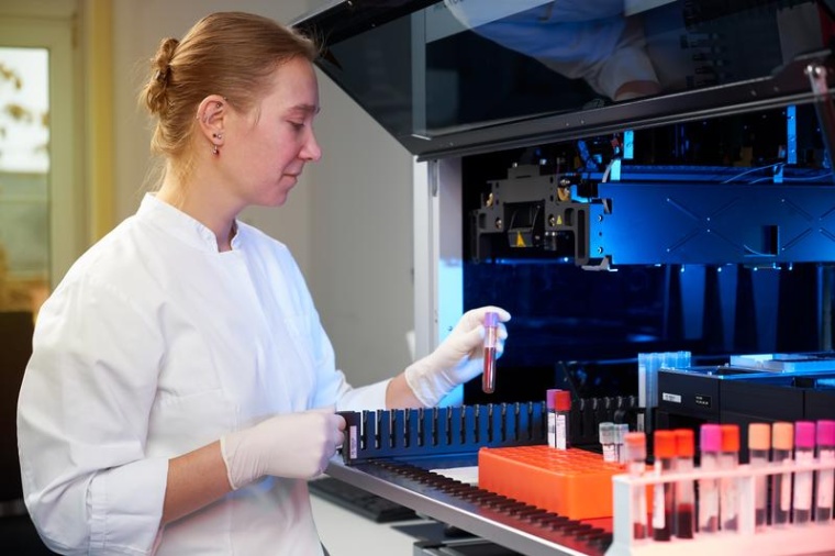 Für die Studie wurden die Harnsäurewerte im Blutserum von Zehntausenden...