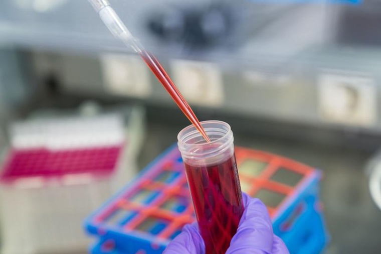 Für das neue, nicht invasive Diagnostikverfahren wird zellfreie DNA aus dem...