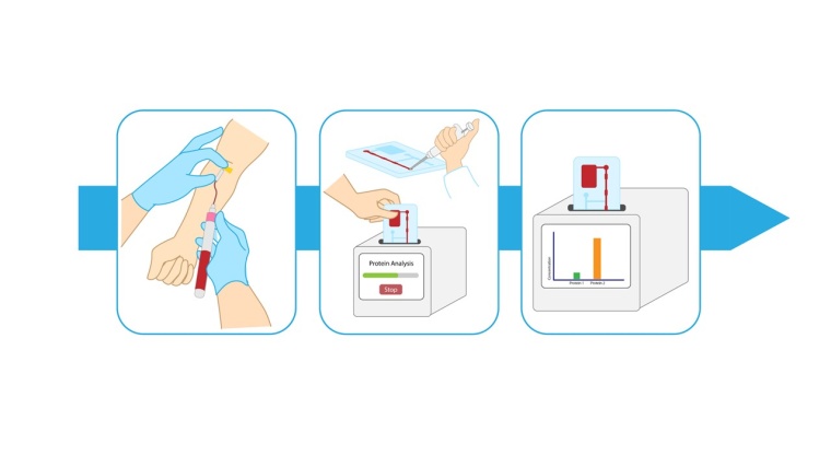 Ablauf einer Proteinanalyse aus venösem Vollblut. Die Überführung der Probe...
