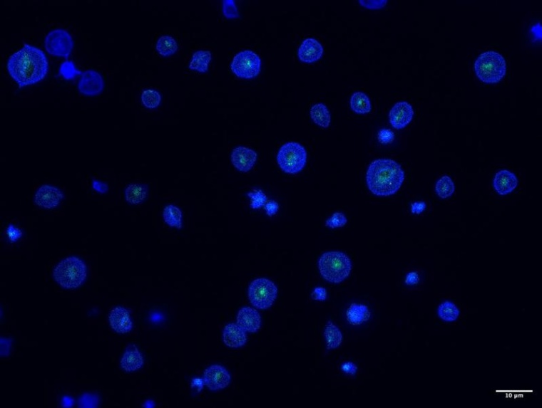 Die retikulierten Bluttplättchen unter dem Mikroskop, das sind besonders...