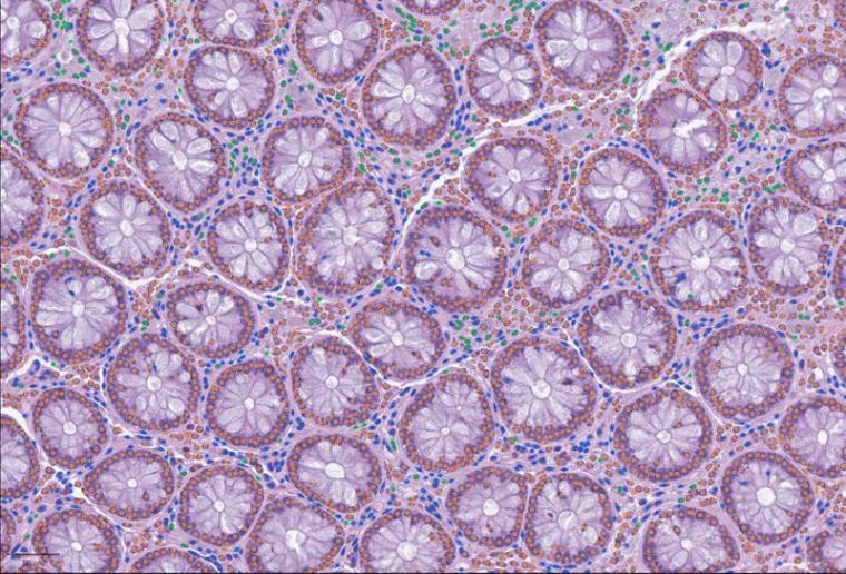 Zelldetektion mit LazySlide in menschlichem Dickdarmgewebe: Immunzellen...