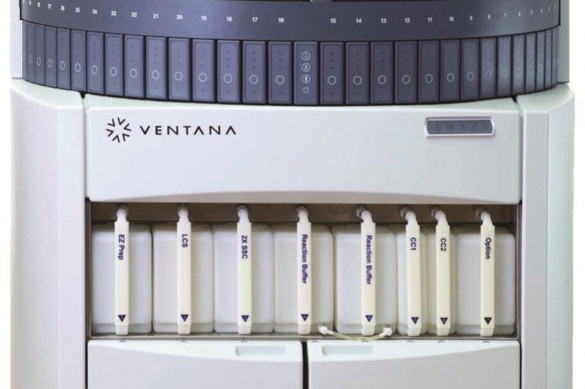 Ventana BenchMark Ultra: multimodales Färbesystem zur Krebsdiagnostik